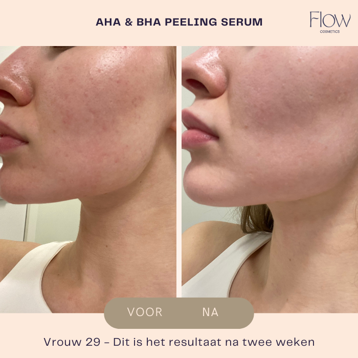 AHA & BHA Peeling Serum - Facial Peeling - Flow Cosmetics - 30ml
