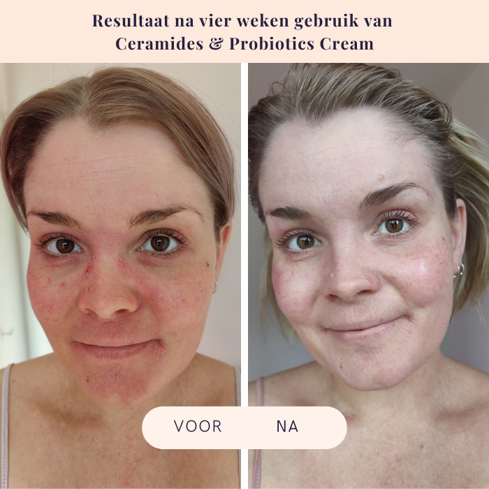 Ceramides & Probiotics Cream - Flow Cosmetics - 50ml